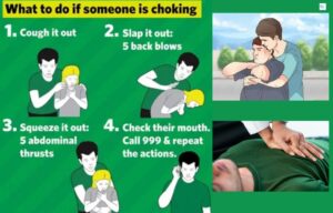 If a Choking Victim Is Too Large