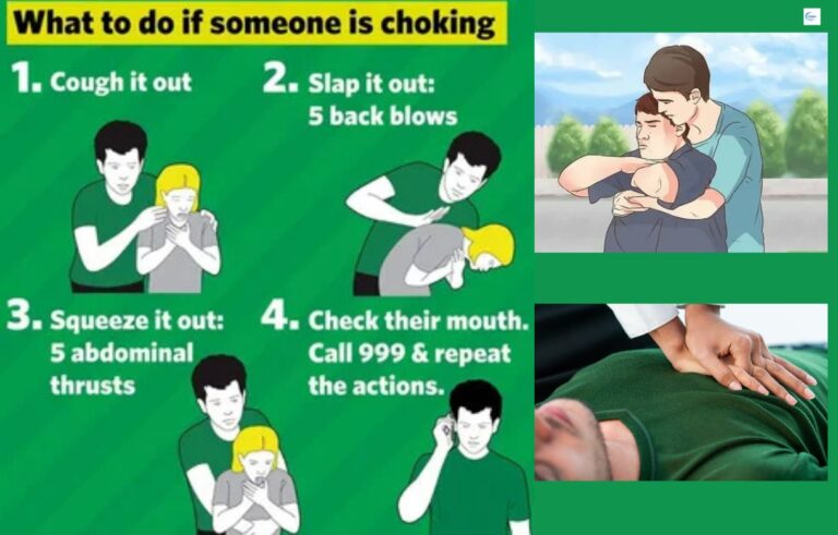 If a Choking Victim Is Too Large